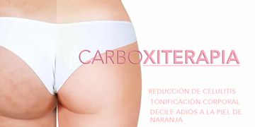 El mejor tratamiento para la celulitis