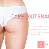 El mejor tratamiento para la celulitis