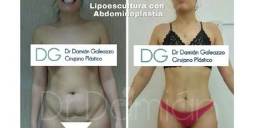 Cómo eliminar la grasa