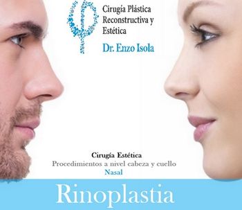 Lo que tenés que saber: Rinoplastia