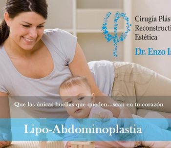 Lo que tenés que saber: Lipo-Abdominoplastia
