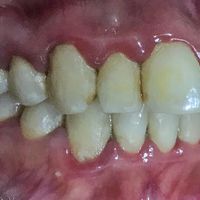 Ortodoncia: estética o salud