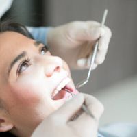 Limpieza dental: La clave para mantener una sonrisa perfecta