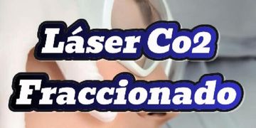 "Láser CO₂ Fraccionado: la revolución estética sin bisturí"