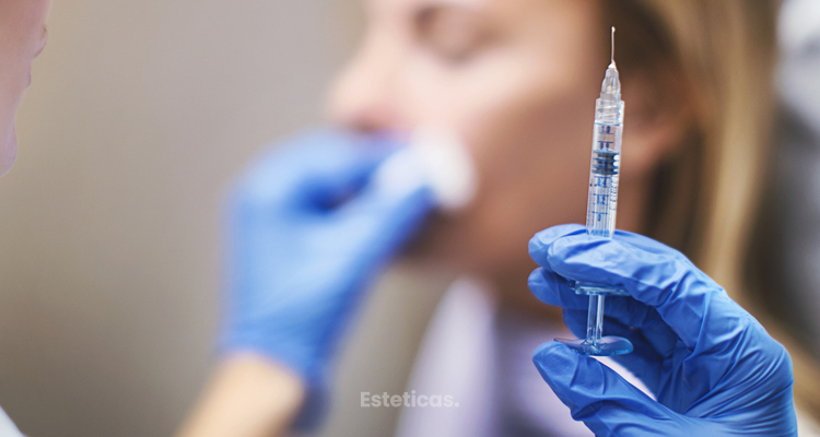 ¿Cuáles son las zonas en la que se aplica Bótox?