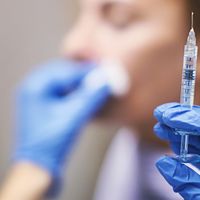 ¿Cuáles son las zonas en la que se aplica Bótox?