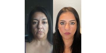 Endolift facial.