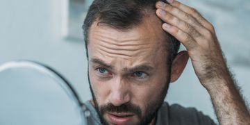 Alopecia vs caída del cabello