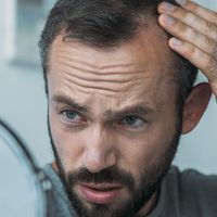 Alopecia vs caída del cabello