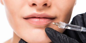 Hialuronidasa en los labios: Una solución para corregir y revertir
