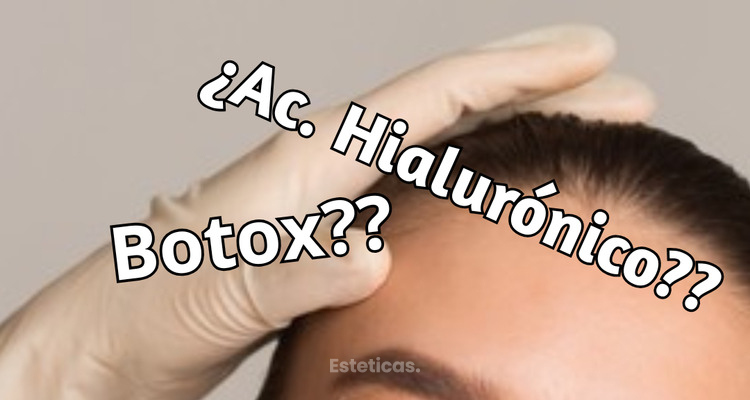 Arrugas de expresión vs. arrugas de soporte: cómo saber si se tratan con Bótox o con ácido hialurónico
