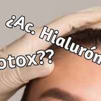 Arrugas de expresión vs. arrugas de soporte: cómo saber si se tratan con Bótox o con ácido hialurónico