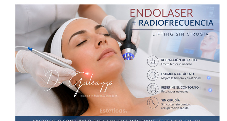 Endolaser + radiofrecuencia: el “lifting sin cirugía” que está cambiando la forma de tratar la flacidez