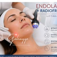 Endolaser + radiofrecuencia: el “lifting sin cirugía” que está cambiando la forma de tratar la flacidez
