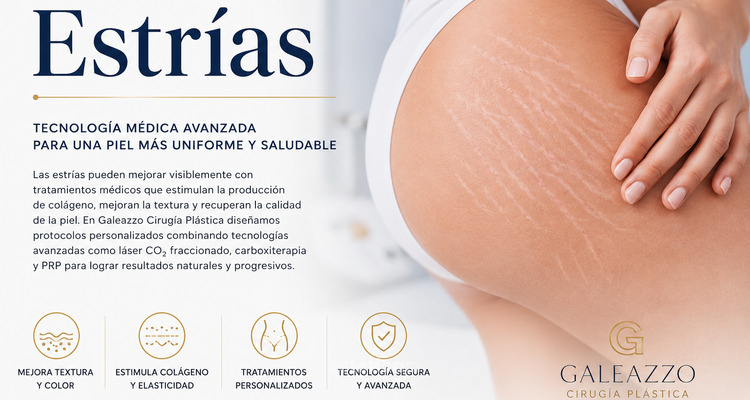 Tratamiento de estrías: cómo mejorar la piel con láser CO2, carboxiterapia y tecnología regenerativa