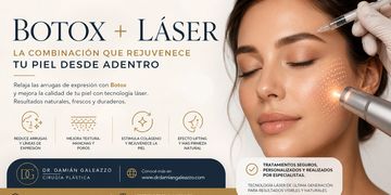 Botox + Láser: la combinación estética que rejuvenece el rostro sin perder naturalidad