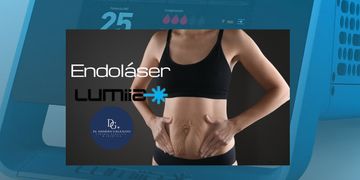 Endoláser Lumiia después de la maternidad: el tratamiento que muchas mujeres eligen para mejorar la “tripita” del bajo vientre sin una cirugía tipica Endoláser Lumiia después de la maternidad: el tratamiento que muchas mujeres eligen para mejorar la “tripita” del bajo vientre sin una cirugía tipica
