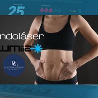 Endoláser Lumiia después de la maternidad: el tratamiento que muchas mujeres eligen para mejorar la “tripita” del bajo vientre sin una cirugía tipica