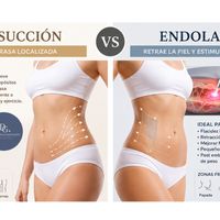 Liposucción vs Endolaser: diferencias, beneficios y cuándo puede indicarse cada tratamiento Liposucción vs Endolaser: diferencias, beneficios y cuándo puede indicarse cada tratamiento