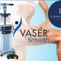 VASER Smooth: la tecnología que redefine el tratamiento de la celulitis y la calidad de la piel
