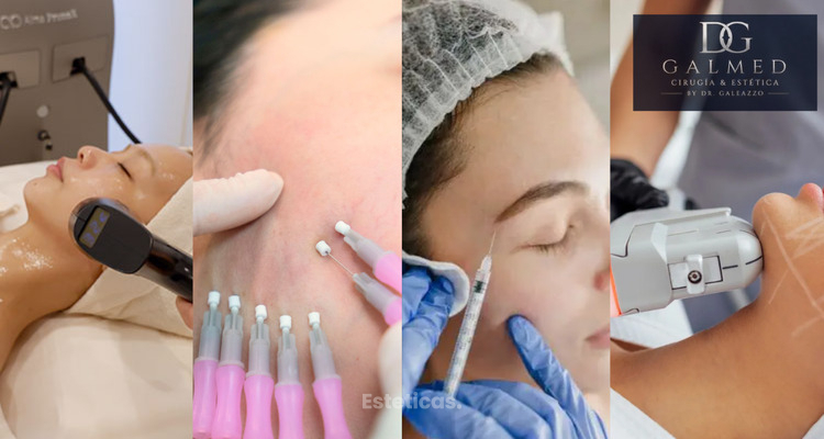 Lifting facial sin cirugía: tratamientos y a qué edad conviene
