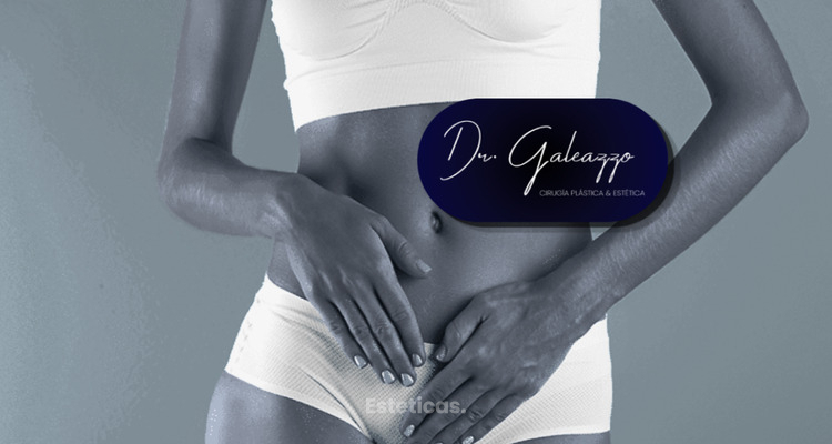 Labioplastia junto con lipoescultura o abdominoplastia: una alternativa para una armonía corporal integral