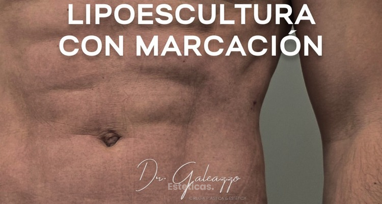 ¿Qué evalúa el Dr. Galeazzo antes de indicar una cirugía?