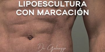¿Qué evalúa el Dr. Galeazzo antes de indicar una cirugía? ¿Qué evalúa el Dr. Galeazzo antes de indicar una cirugía?
