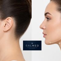 ¿Con qué se puede combinar la lipopapada? Endolaser, HIFU y rellenos
