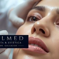Baby Botox: qué es, cómo funciona y por qué busca un resultado natural
