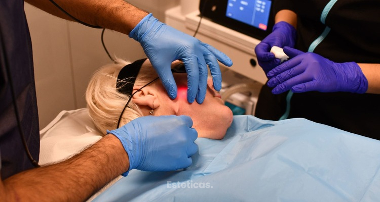 Endolifting facial: qué es y cómo funciona.