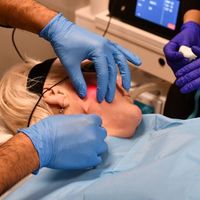Endolifting facial: qué es y cómo funciona.