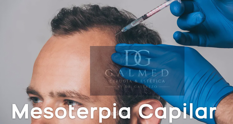 Mesoterapia capilar: qué es, cómo se realiza y cuándo puede estar indicada para la caída del cabello
