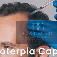 Mesoterapia capilar: qué es, cómo se realiza y cuándo puede estar indicada para la caída del cabello