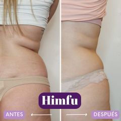 HIFU - Centro IMEL