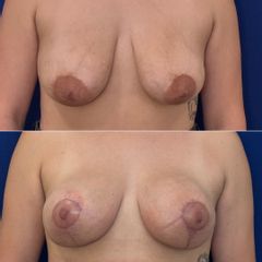 Mastopeixa - Dr. Alejandro Silvestre