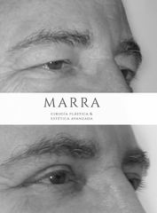 Blefaroplastia + Cola de Ceja - Clinica Marra