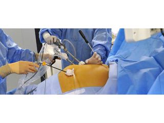 cirugia miniinvasiva 1