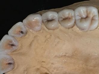 Prótesis dentales - 625819