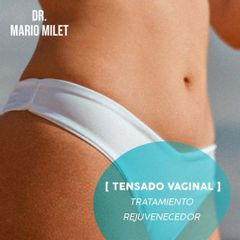 Rejuvenecimiento Vaginal - Dr. Mario Eduardo Milet