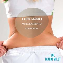 Lipo Láser - Dr. Mario Eduardo Milet