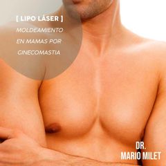 Ginecomastia - Dr. Mario Eduardo Milet