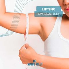 Lifting de Brazos - Dr. Mario Eduardo Milet