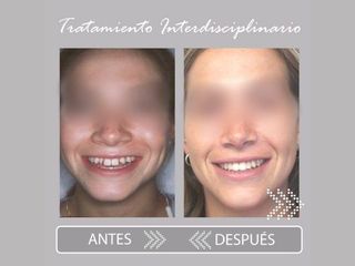 Ortodoncia - Clínica Creo