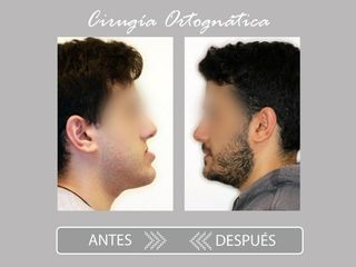 Cirugía maxilofacial - Clínica Creo