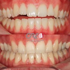 Ortodoncia - Clinica Creo