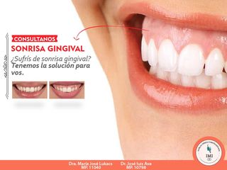 sonrisa gingival