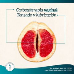 Carboxiterapia Vaginal: mejora el tensado y la lubricacion vaginal, entre otros beneficios.