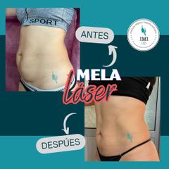 MELA - Dr. Jose Luis Ava
