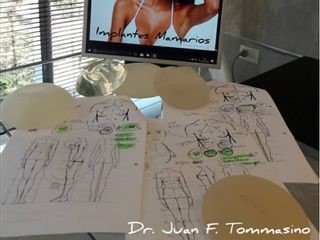 Cirugía Plástica Dr. Juan Tommasino 